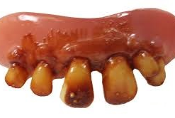 Billy Bob Meth Teeth