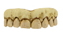 Billy Bob Skeleton Gebit